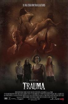 Травма